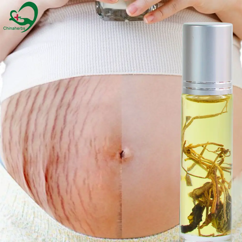 Private label smagliature olio organico naturale corpo incinta rimozione cicatrice massaggio segni di gravidanza cicatrici del corpo