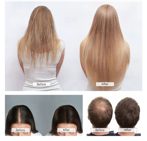 Cordless Steam Electric Red Light Custom Scalp Massage Hair Straightener Heating <b>Hot</b> <b>Comb</b> for Wigs Hair Brushes - Product Image 6