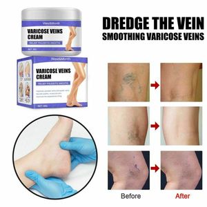 Allevia la vagina da flebite migliora la circolazione sanguigna crema per le vene Varicose - Product Image 5