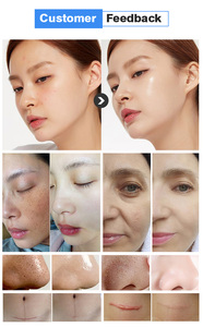 Nouvelle machine populaire multifonctionnelle de soin de la peau Hydrocare Water Facial Dermabrasion - Product Image 3