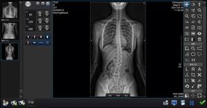 Detector DE RAYOS X de panel plano DR eléctrico con sistema CR Tecnología Digital IRAY Equipos y accesorios de radiología - Product Image 5