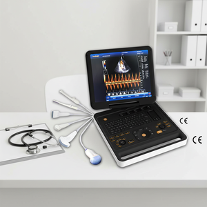 Équipement médical hospitalier <span class=keywords><strong>en</strong></span> gros : Échographe portable <span class=keywords><strong>3D</strong></span> Doppler Couleur PW - Product Image 1