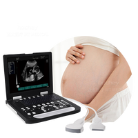 MT Medical portátil Doppler diagnóstico veterinario máquina de ultrasonido sistema de ultrasonido Color Doppler perro dispositivo de diagnóstico ultrasónico