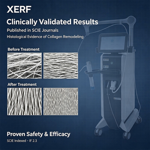 เครื่องยกกระชับผิวหน้า XERF ระดับมืออาชีพ เครื่อง XERF ความถี่คู่ 6.78MHz + 2MHz สำหรับปรับรูปหน้า เครื่องเสริมความงามสำหรับร้านเสริมสวย - Product Image 6