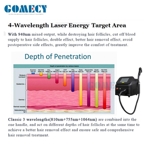 เครื่องกำจัดขนด้วย<span class=keywords><strong>เลเซอร์</strong></span>ไดโอด Gomecy Best 4 ความยาวคลื่น 1200W 1600W 755nm 808nm 940nm 1064nm สำหรับกำจัดขนตามร่างกายและใต้วงแขน - Product Image 3