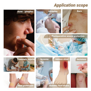 Botiquín de primeros auxilios flexible e impermeable, vendaje hidrocoloide autoadhesivo esencial de grado médico, rollo de hidrocoloide para el cuidado de heridas - Product Image 3