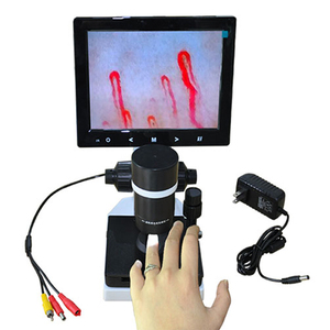 Xách tay <span class=keywords><strong>400X</strong></span> <span class=keywords><strong>USB</strong></span> kính hiển vi kỹ thuật số cho móng tay gấp mao mạch máu vi tuần hoàn quan sát - Product Image 4