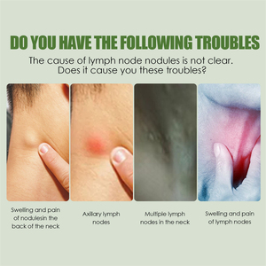 Rodillo de limpieza linfática OEM South Moon, 1 pieza, ganglios linfáticos, hinchazón, alivio del dolor, herramienta de rodillo de masaje corporal linfático - Product Image 2