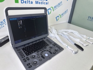 Ecógrafo Veterinario Sonoscape E2/E10/E11 Doppler Color para Perros, Gatos y Caballos con Sonda Rectal y Convexa - Product Image 4