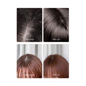 Etiqueta privada OEM Romero champú para el cabello para hombres 2 en 1 champú - Product Image 6