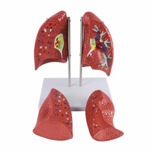 نموذج تشريحي للرئة بالحجم الطبيعي 4 أجزاء نموذج نظام التنفس البشري التدريس الطبي للمدرسة والمستشفى - Product Image 1