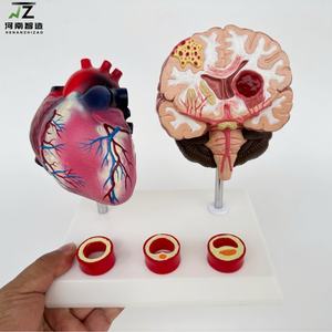 Maniquí de Demostración para la Enseñanza de Enfermedades Cardiovasculares y Cerebrovasculares Humanas, con Edad y Tamaño Real, en PVC Avanzado - Product Image 6