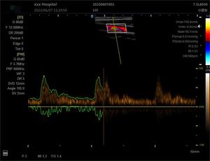 15 pulgadas médico doble sonda cuaderno Usb veterinario Eco Color Doppler portátil ultrasonido precio - Product Image 5