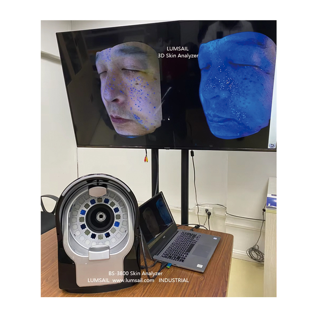 Skin Analyzer Facial Analyzers for Cosmetologists Dermatologists and Plastic Surgeons