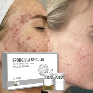Tốt nhất alidina Bio tảo lột spongilla SPicule mụn tối mụn vết rạn da vết sẹo loại bỏ nếp nhăn & nếp nhăn cho Salon - Product Image 1