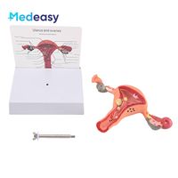 Modelo de anatomía del útero y ovario femenino Medeasy, modelo de útero normal y con enfermedades, con base desmontable para la enseñanza de enfermería médica