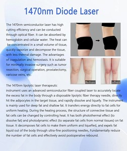 Les dernières technologies d'équipement à prix réduit sont dotées d'une technologie de protection physique à double longueur d'onde, garantissant que la peau n'est pas endommagée. - Product Image 4