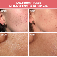 Lot de Soins Visage Pastèque : Collagène, Vitamine C, Acide Hyaluronique – Hydratant, Anti-rides, Éclaircissant