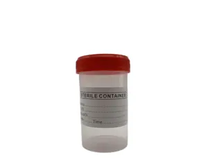 Contenedor de muestras de orina de hospital, consumibles médicos de plástico desechables, copa de muestra de orina de 60ml