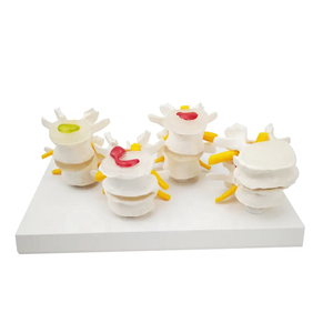 Tussenwervelschijf Degeneratie Osteoporose Model Lumbale Hernia Model Normale Plastic Lumbale Wervelkolom Model - Product Image 5