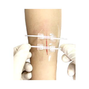 Cierre de heridas Apósito quirúrgico para el cuidado de heridas para heridas Kit de cierre de laceración de emergencia para laceraciones y cortes - Product Image 1