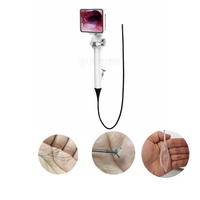 Laryngoscope vidéo flexible nasopharyngoscope flexible bronchoscope urétéroscope flexible urologie rhino-laryngoscope néphroscope