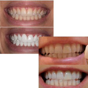 Esencia Blanqueadora Dental, Suero para el Cuidado Bucal, Limpiador, <span class=keywords><strong>Blanqueador</strong></span>, Elimina Manchas de Placa, Refresca el Aliento - Product Image 4