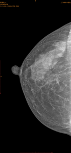 Nuevo estilo Radiolog X Ray Detector de mamografía de panel plano - Product Image 4