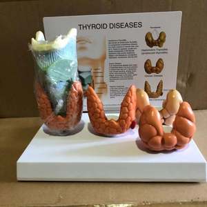 Патологическая модель щитовидной железы - Product Image 2