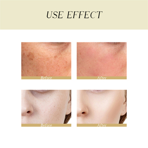 Etiqueta privada Cuidado de la piel facial Belleza Antienvejecimiento Reduce las arrugas Reparación efectiva Se desvanecen Pecas Crema facial para eliminar manchas oscuras - Product Image 3