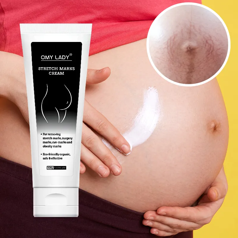 Lage Moq Na Zwangerschap Natuurlijke Reparatie Whitening Huid Verwijderen Reparatie Anti Striae Striae Crème