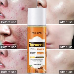 OEM özel etiket koyu noktalar <span class=keywords><strong>Toner</strong></span> bile cilt tonu silgi düzeltici cilt beyazlatma sıkılaştırıcı akne yüz zerdeçal <span class=keywords><strong>Toner</strong></span> kaldırmak - Product Image 6
