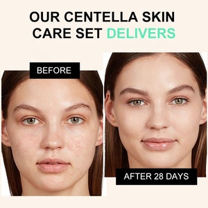 Cuidado DE LA PIEL coreano Centella Asiatica CICA <span class=keywords><strong>Kit</strong></span> Anti-envejecimiento Reafirmante Brillo Cuidado DE LA PIEL Set para mujeres Piel grasa - Product Image 4