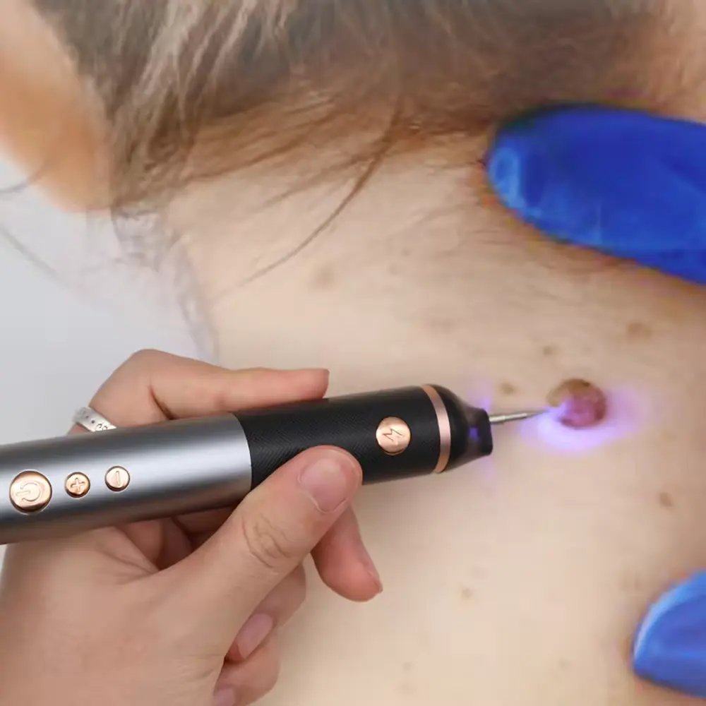 2024 Trending Products Face Spot Pen Gold Color Plasma Pen Electric Laser Face Freckle Dot Mole Dark Spot Tattoo Removal Pen