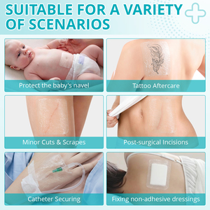 ELAIMEI 50 Paquetes de Parches Transparentes de Adhesión Segura para Cuidado de Heridas, Apósito Transparente de Alginato Plateado para Heridas - Product Image 3