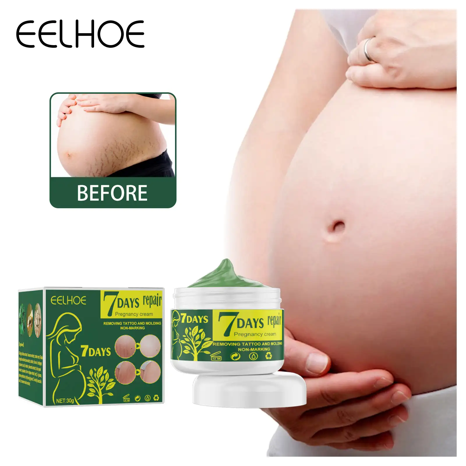 Eelhoe Remove Stretch Marks Cream Firming Body Lotion Slimming Cellulite Massage Treatment Body Skin Care Health Lift 10g/30g