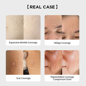 Pigments de Camouflage Teint Chair pour <span class=keywords><strong>Tatouage</strong></span> Permanent OEM – Encres PMU - Product Image 3