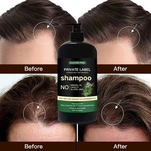 Prix usine Romarin Shampooing et après-shampoing Set-Croissance des cheveux Anti perte de cheveux Arbre à thé Contrôle de l'huile pour cheveux secs et abîmés - Product Image 4