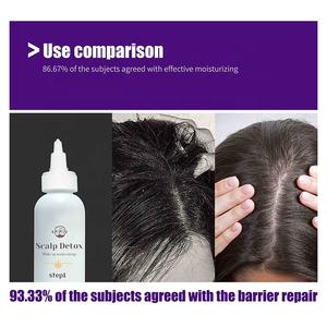 Gel nettoyant professionnel pour le <span class=keywords><strong>cuir</strong></span> <span class=keywords><strong>chevelu</strong></span>, anti-pelliculaire, détoxifiant, rafraîchissant, anti-démangeaisons, réparateur du <span class=keywords><strong>cuir</strong></span> <span class=keywords><strong>chevelu</strong></span>, pour le <span class=keywords><strong>psoriasis</strong></span>, à utiliser avant le <span class=keywords><strong>shampoing</strong></span> - Product Image 3