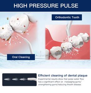 300ml IPX8 hilo <span class=keywords><strong>dental</strong></span> recargable viaje <span class=keywords><strong>Dental</strong></span> eléctrico portátil irrigador Oral limpiador de dientes inalámbrico hilo <span class=keywords><strong>dental</strong></span> de agua - Product Image 6