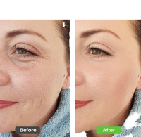 Appareil facial électrique portatif à micro-courant ABS anti-âge, rajeunissement des rides, raffermissement de la peau, prises EU/UK/AU/US, usage beauté