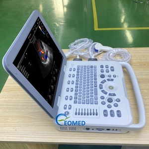 Ecógrafo Doppler Color Veterinario Portátil de Alto Rendimiento para Ganado y Mascotas CU30-2vet - Product Image 5