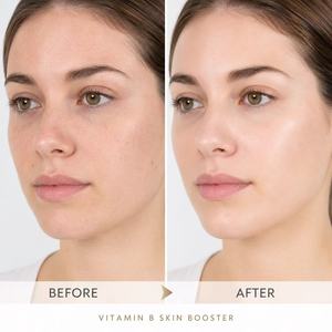 <span class=keywords><strong>Prix</strong></span> de gros Hyalrix Vitamine B Gel Booster Cutané 3ml Solution Injectable d'<span class=keywords><strong>Acide</strong></span> <span class=keywords><strong>Hyaluronique</strong></span> pour l'Hydratation du Visage et l'Amélioration de la Qualité de la Peau - Product Image 2