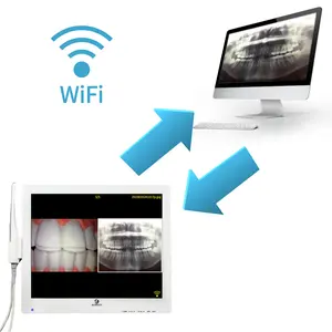 الأكثر مبيعاً في كاميرا الأسنان داخل الفم الأوروبية بكسل واي فاي لـ ،