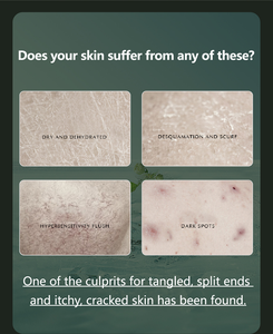 Popular SPE Cabezal de ducha ABS de alta presión Suplemento DE SALUD Filtración Pulverización de hidrógeno - Product Image 6