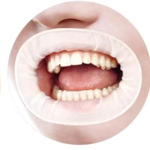 O forma dentaria apribottiglie per dighe in gomma intraorale riavvolgitori bianchi multiuso per chirurgia di igiene orale - Product Image 1