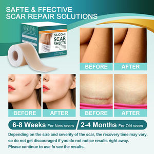 Cinta de Silicona Personalizada para Cicatrices y Arrugas Faciales - Product Image 6