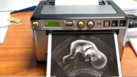 Papel Térmico para Ultrasonido de Grado Médico – Imagen Negra de Alta Definición