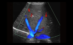 Échographe Doppler Couleur 4D/5D sur Chariot Mindray Z.One PRO pour Usage Vétérinaire en Milieu Hospitalier - Product Image 5