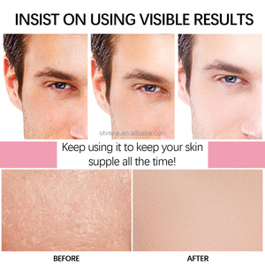 Crema Facial Blanqueadora y Nutritiva OTVENA con Vitamina C Orgánica y Sin Sulfatos <span class=keywords><strong>para</strong></span> Mujeres - Product Image 4